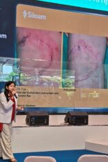 Perdana Bedah Plastik, Rekonstruksi dan Estetik dengan Standar Korea Selatan di Siloam Hospital TB Simatupang