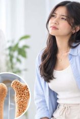 Merasa Sehat? Belum Tentu Tulangmu Kuat Osteoporosis Bukan Cuma untuk Lansia